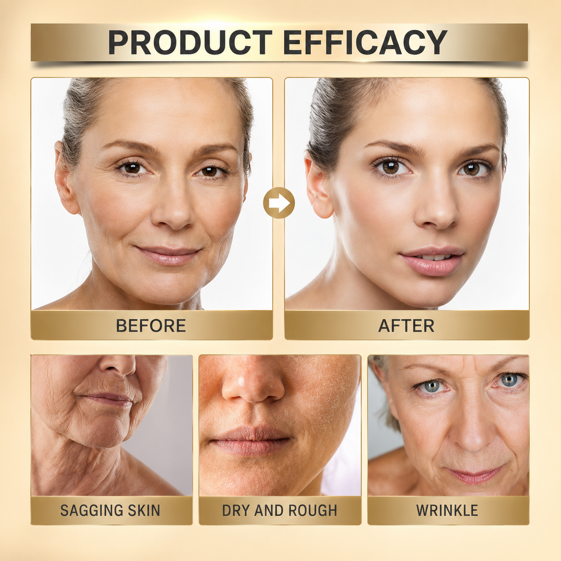 OUHOE - Bee Venom Botox Wrinkle Cream